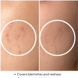 Powder Foundation with Salicylic Acid - 2